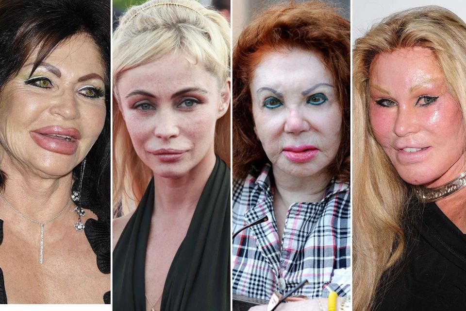 Красота или катастрофа: знаменитости, потерявшие привлекательность из-за пластики