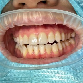 ���������������� �������: ������, ������� ������ ��