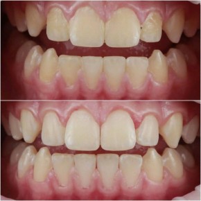 ��������� ������: ��� ������ ������ ����� ������ �� ��������